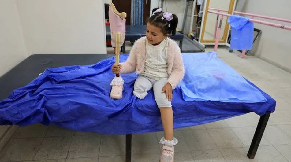 Gazze Savaşında Yaklaşık 8.000 Kişinin Ampute Edildiği Bildirildi